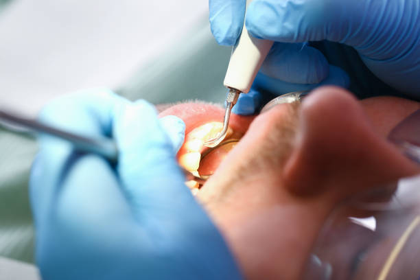 Best 24-Hour Emergency Dental Care in Nolanville, TX