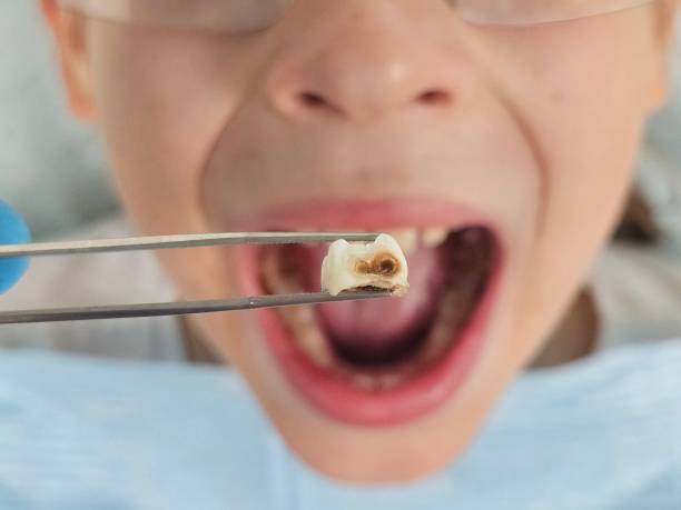 Best Emergency Pediatric Dental Care in Nolanville, TX